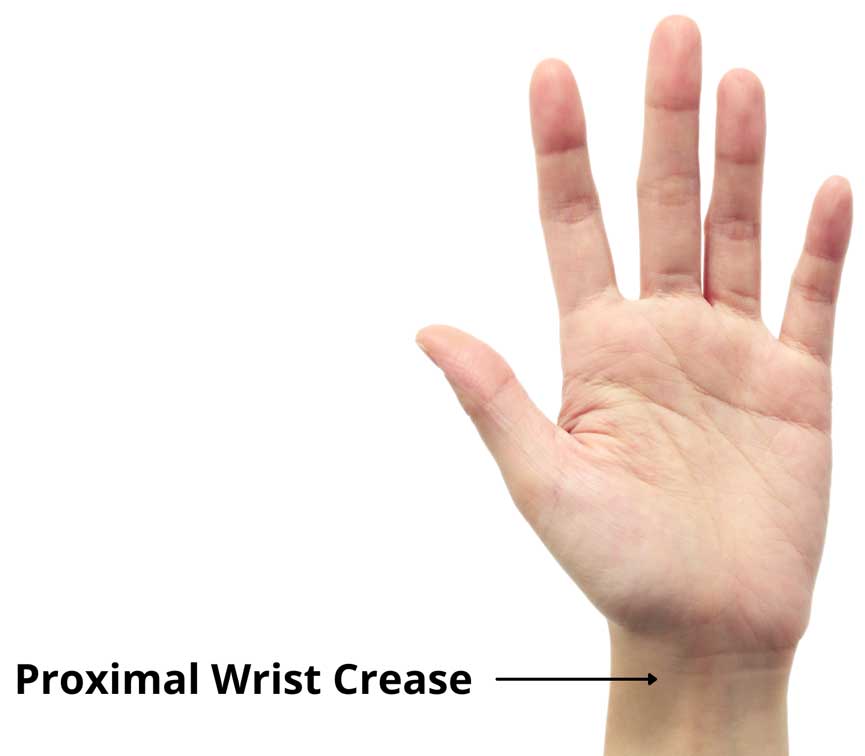 Proximal wrist crease