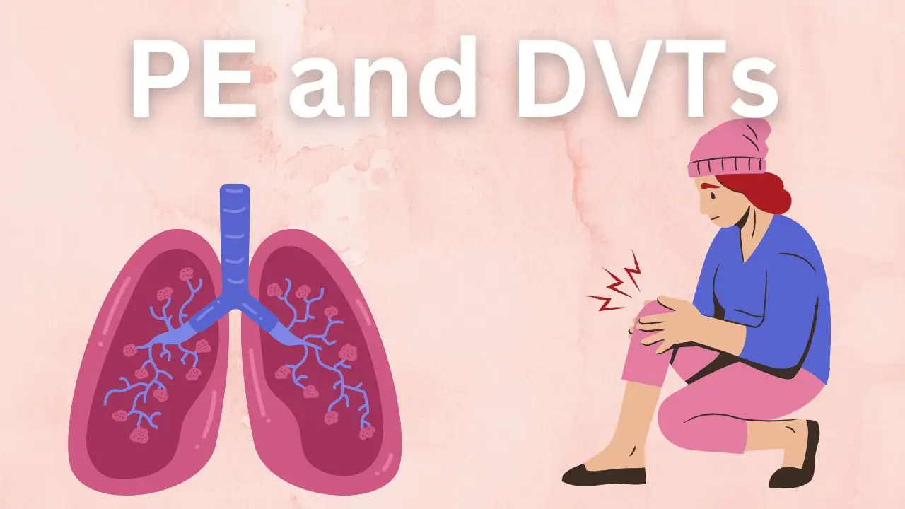 is it safe to walk with PE or DVT